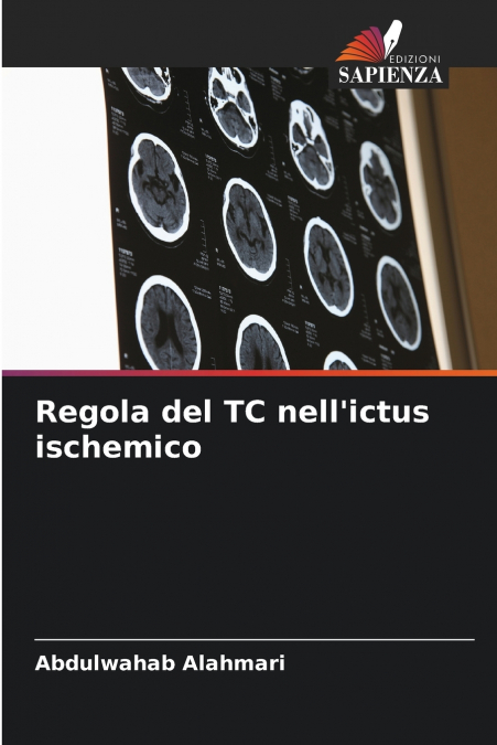 Regola del TC nell’ictus ischemico