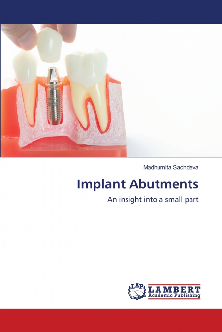 Implant Abutments