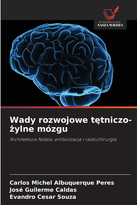 Wady rozwojowe tętniczo-żylne mózgu