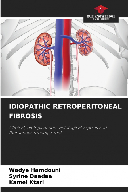 IDIOPATHIC RETROPERITONEAL FIBROSIS