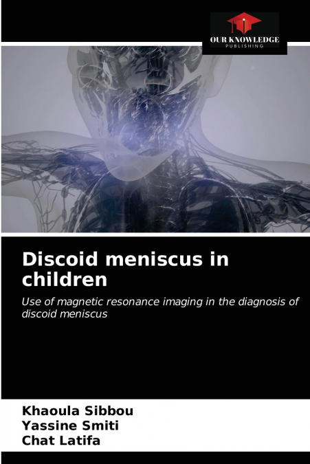 Discoid meniscus in children