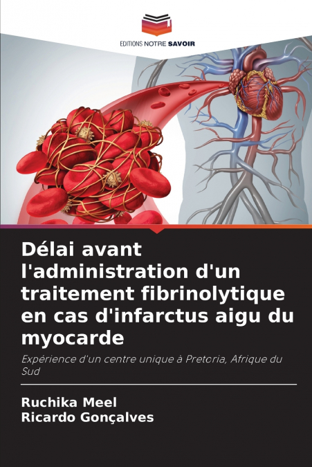 Délai avant l’administration d’un traitement fibrinolytique en cas d’infarctus aigu du myocarde