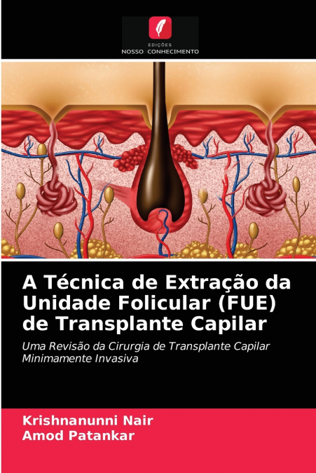 A Técnica de Extração da Unidade Folicular (FUE) de Transplante Capilar