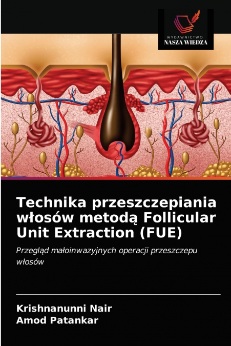 Technika przeszczepiania włosów metodą Follicular Unit Extraction (FUE)
