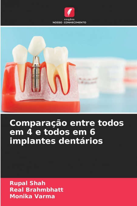 Comparação entre todos em 4 e todos em 6 implantes dentários