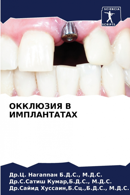 ОККЛЮЗИЯ В ИМПЛАНТАТАХ