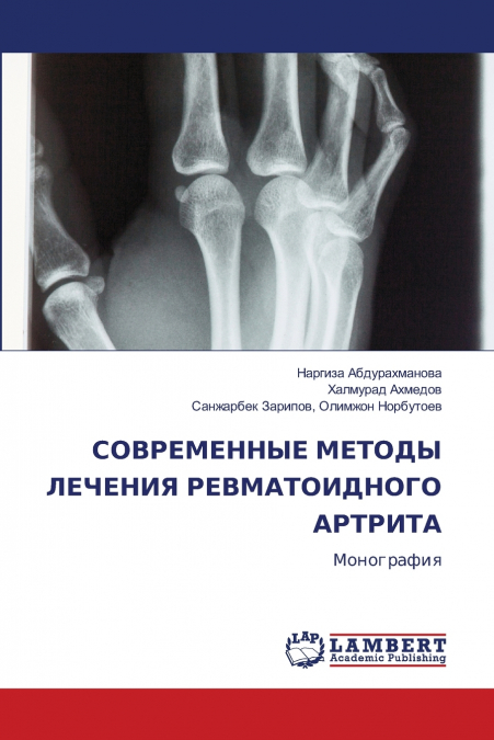 СОВРЕМЕННЫЕ МЕТОДЫ ЛЕЧЕНИЯ РЕВМАТОИДНОГО АРТРИТА