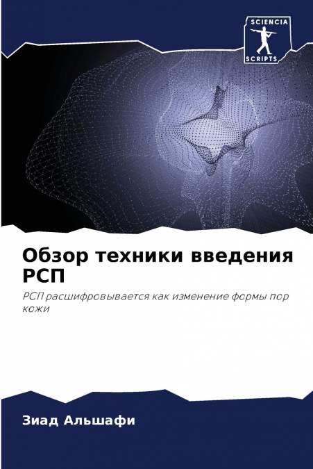 Обзор техники введения РСП