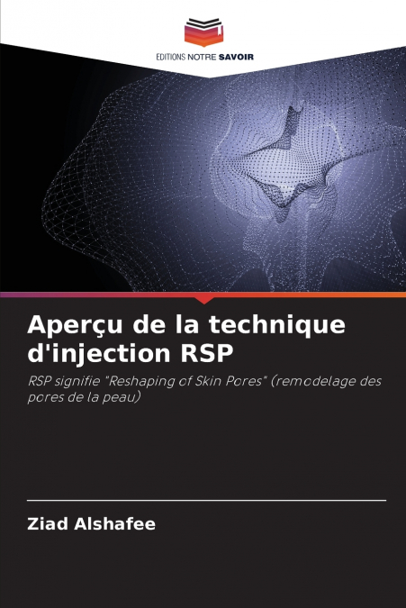 Aperçu de la technique d’injection RSP