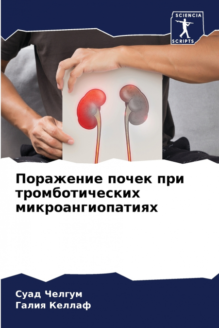 Поражение почек при тромботических микроангиопатиях