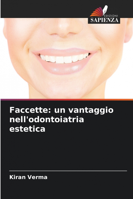 Faccette