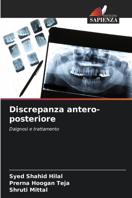 Discrepanza antero-posteriore