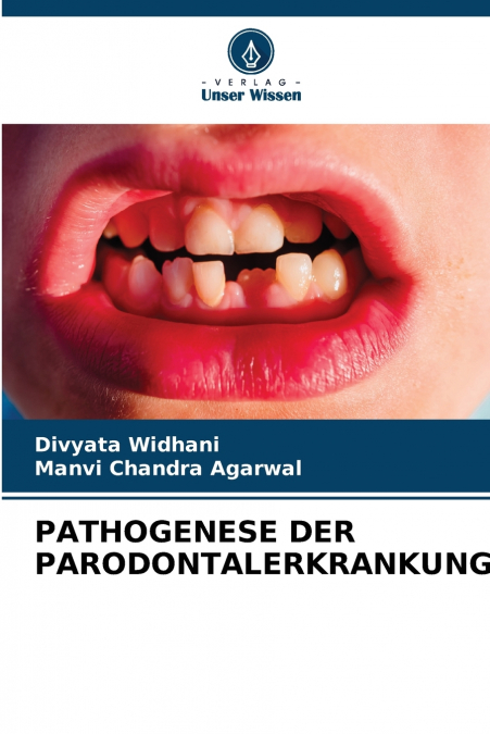 PATHOGENESE DER PARODONTALERKRANKUNG