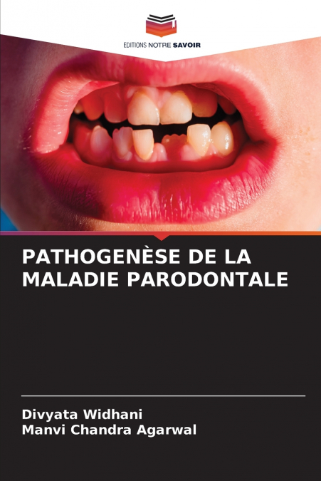 PATHOGENÈSE DE LA MALADIE PARODONTALE