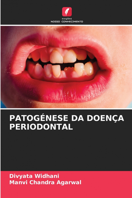 PATOGÉNESE DA DOENÇA PERIODONTAL