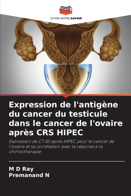 Expression de l’antigène du cancer du testicule dans le cancer de l’ovaire après CRS HIPEC