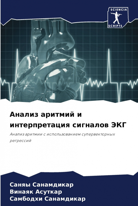 Анализ аритмий и интерпретация сигналов ЭКГ