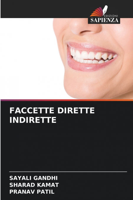 FACCETTE DIRETTE INDIRETTE