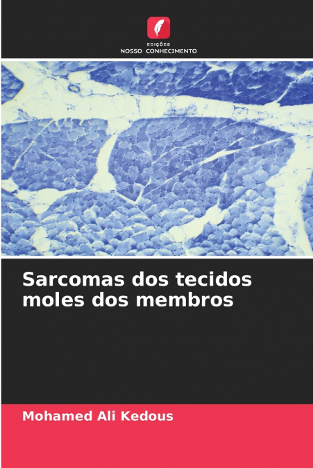 Sarcomas dos tecidos moles dos membros