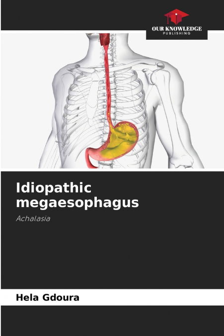 Idiopathic megaesophagus