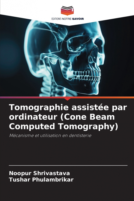 Tomographie assistée par ordinateur (Cone Beam Computed Tomography)