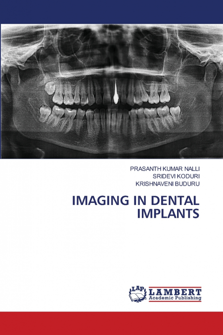 IMAGING IN DENTAL IMPLANTS