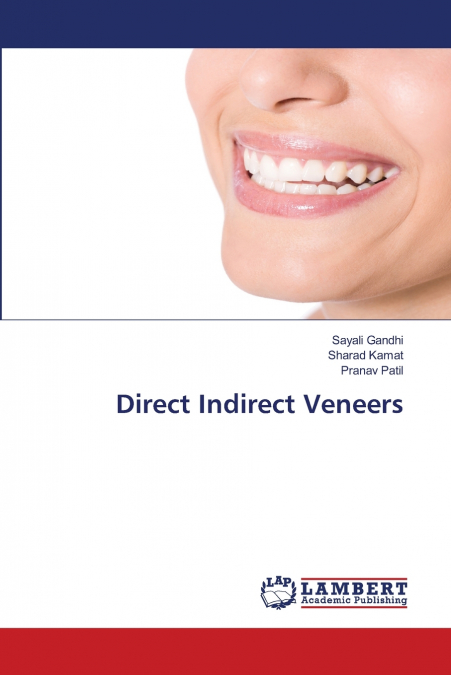 Direct Indirect Veneers