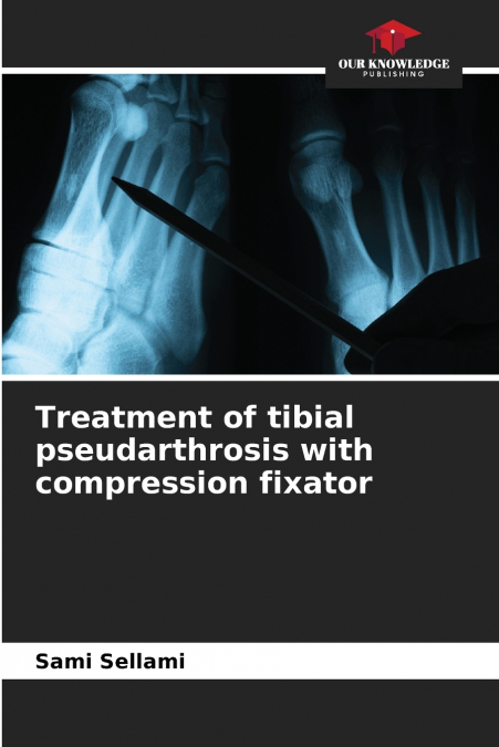 Treatment of tibial pseudarthrosis with compression fixator