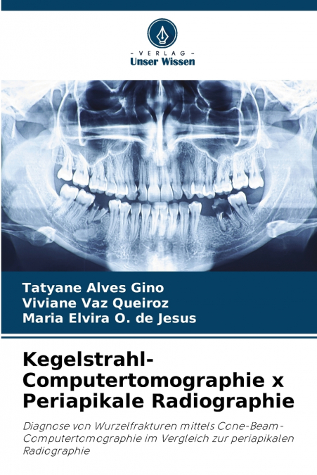Kegelstrahl-Computertomographie x Periapikale Radiographie