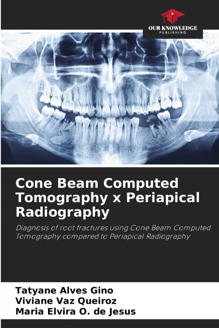 Cone Beam Computed Tomography x Periapical Radiography