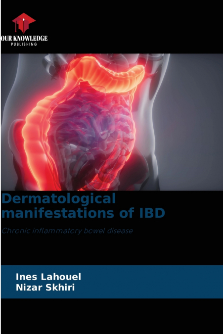 Dermatological manifestations of IBD