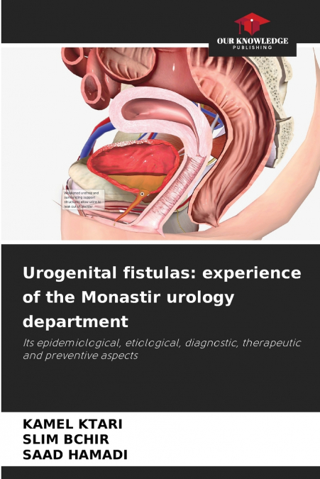 Urogenital fistulas