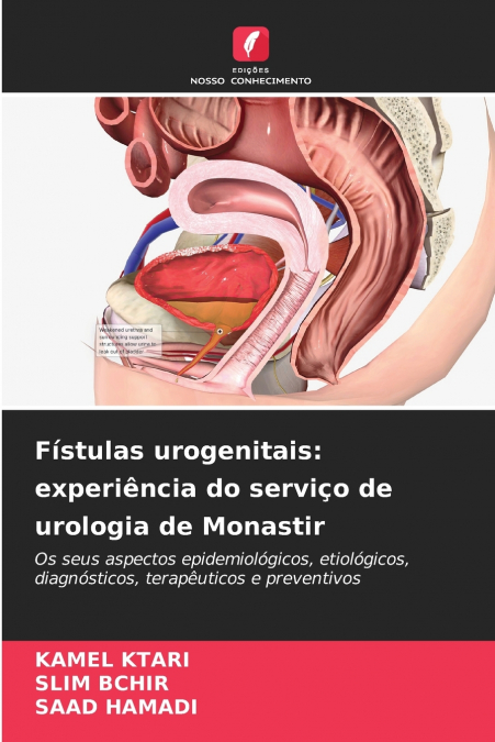Fístulas urogenitais