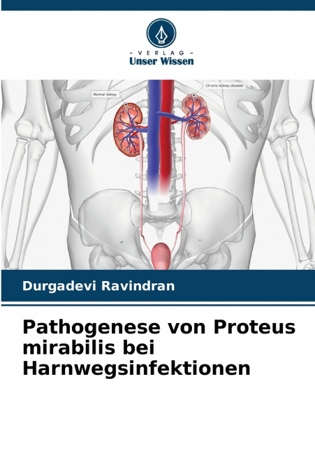 Pathogenese von Proteus mirabilis bei Harnwegsinfektionen