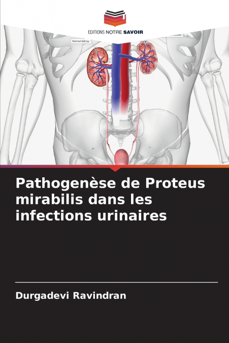 Pathogenèse de Proteus mirabilis dans les infections urinaires