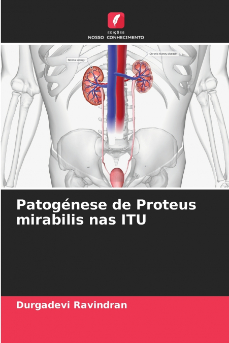 Patogénese de Proteus mirabilis nas ITU