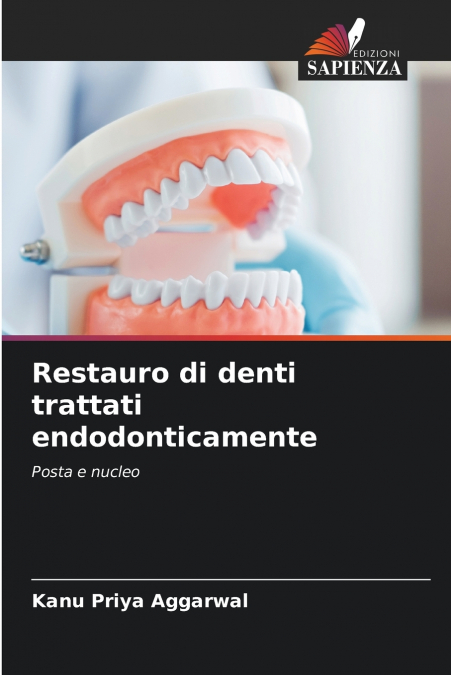 Restauro di denti trattati endodonticamente
