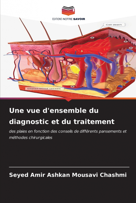 Une vue d’ensemble du diagnostic et du traitement