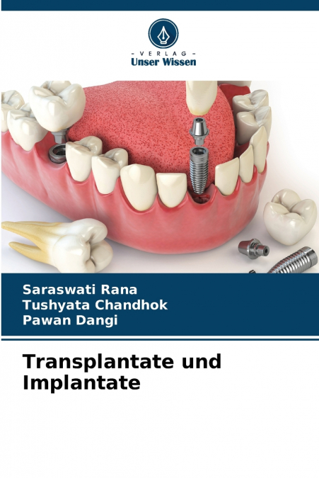 Transplantate und Implantate