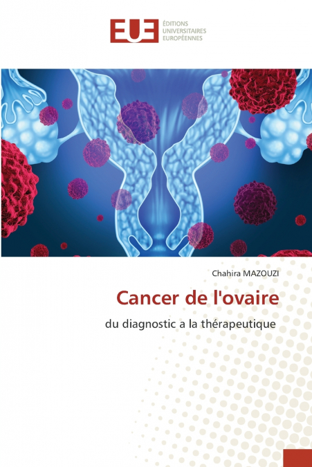 Cancer de l’ovaire