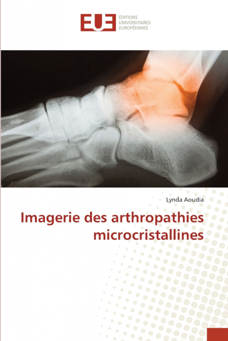 Imagerie des arthropathies microcristallines