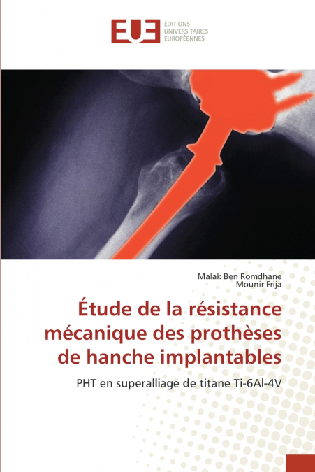 Étude de la résistance mécanique des prothèses de hanche implantables