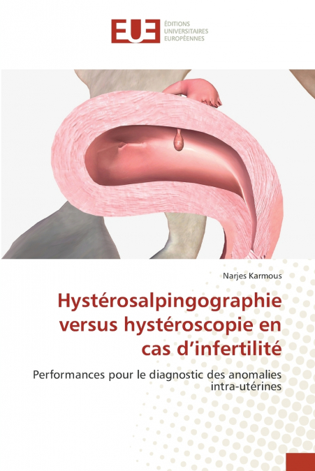 Hystérosalpingographie versus hystéroscopie en cas d’infertilité