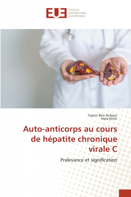 Auto-anticorps au cours de hépatite chronique virale C