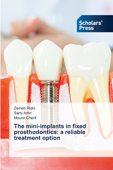 The mini-implants in fixed prosthodontics