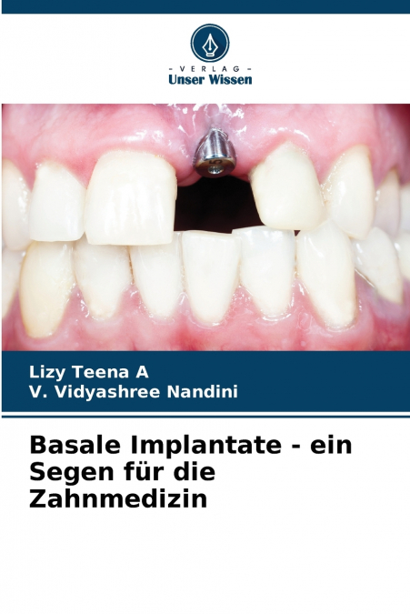 Basale Implantate - ein Segen für die Zahnmedizin