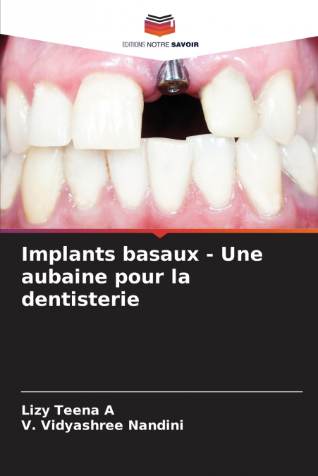 Implants basaux - Une aubaine pour la dentisterie