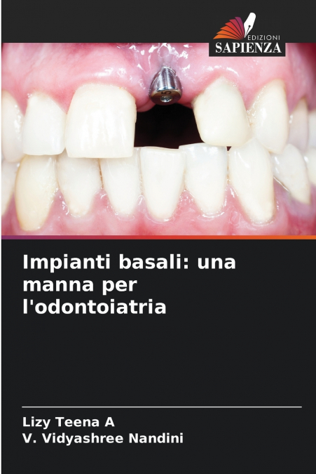 Impianti basali