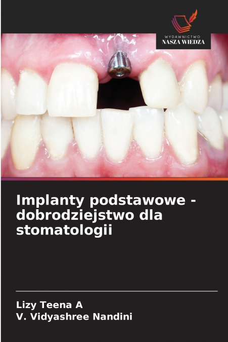 Implanty podstawowe - dobrodziejstwo dla stomatologii