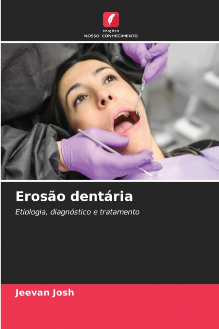 Erosão dentária